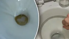 Žlté škvrny zmiznú do 1 hodiny: Čo nasypať do záchoda
